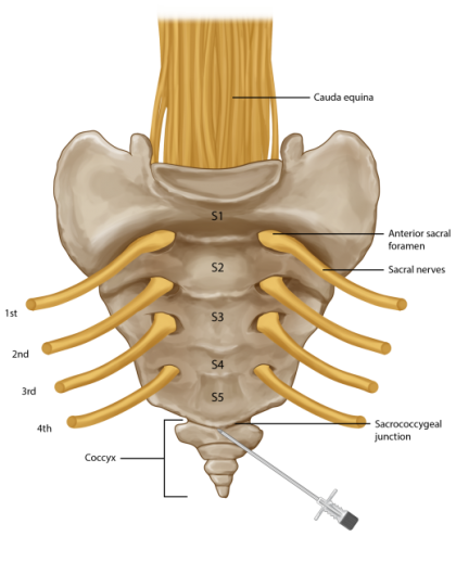 Coccyx injection opt