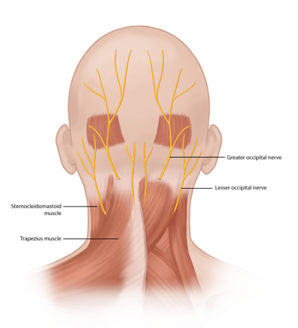 Occipital Neuralgia Treatment Headache Pain Relief Pain Spa occipital-neuralgia-treatment-headache-pain-relief-pain-spa