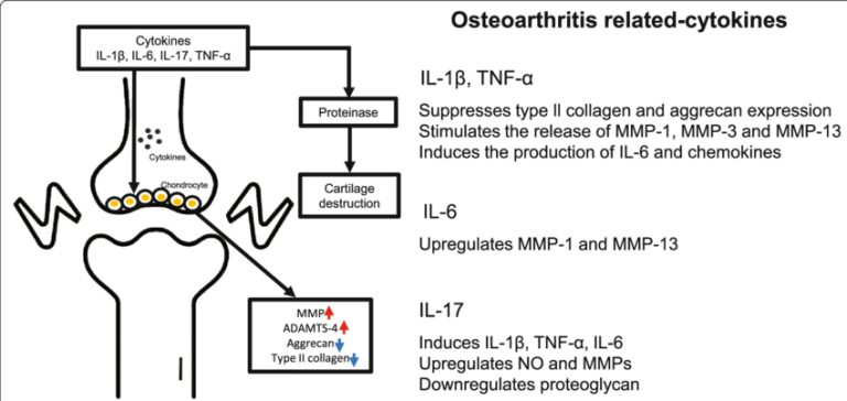 The role of proinflammatory cytokines in the pathophysiology of OA The role of