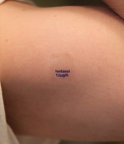 fentanyl patch