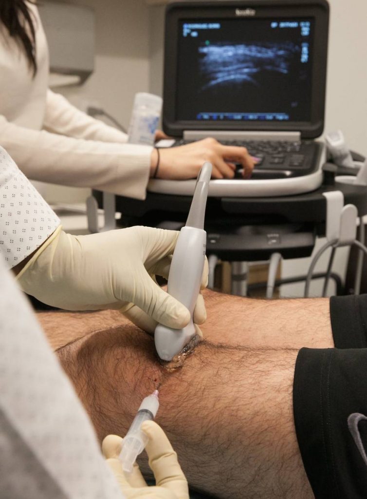 ultrasound guided injections