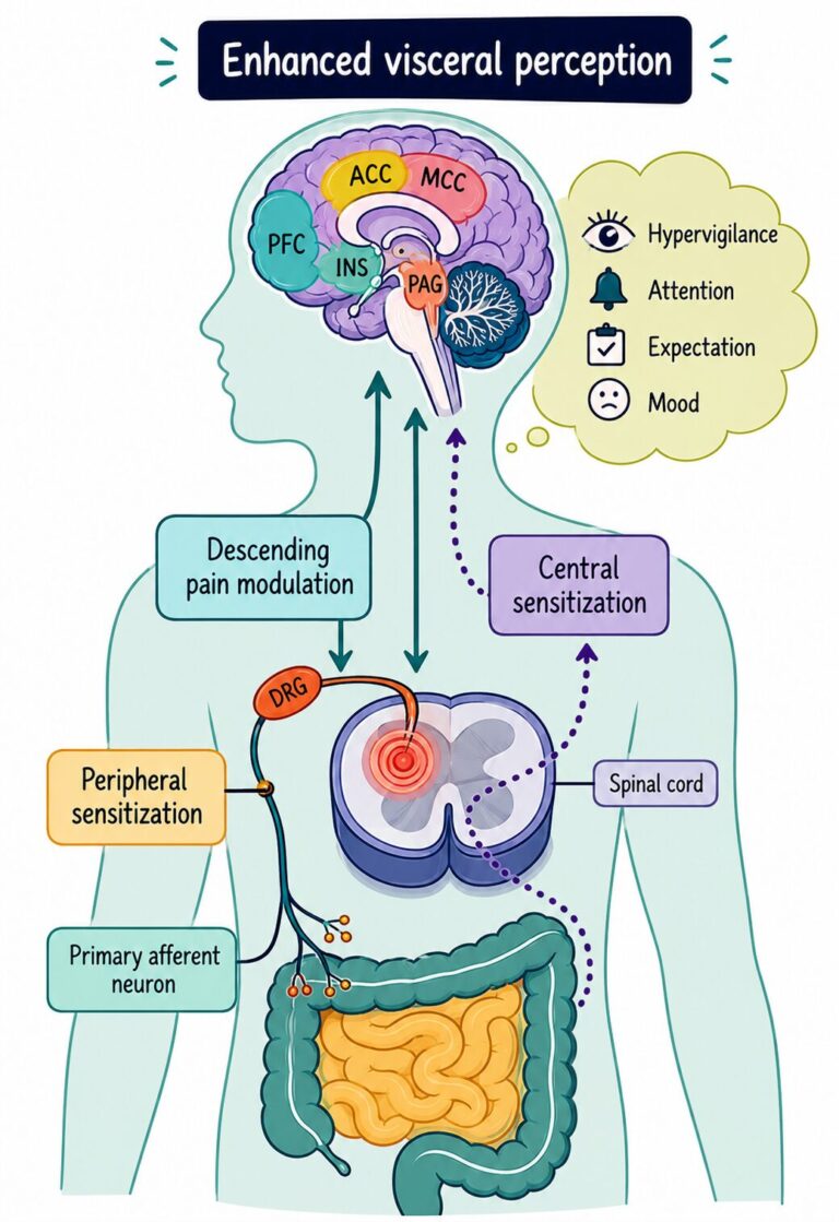 visceral sensitisation